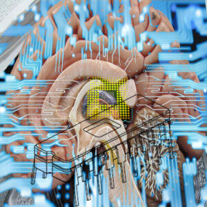 brain chip