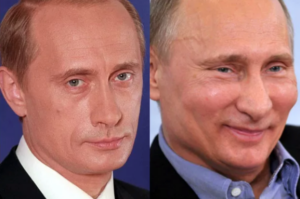 putin botox