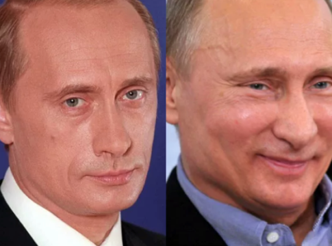 putin botox