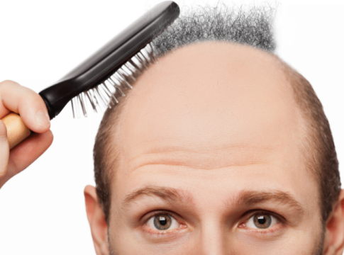 bald-hair-pubic-cure.3png