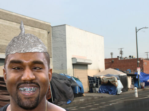 kanye west dental implants