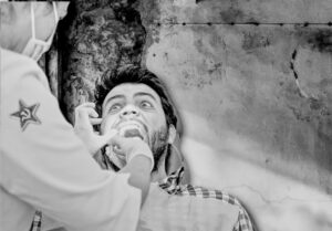 gold tooth extraction soviet britain bw GOLD TEETH